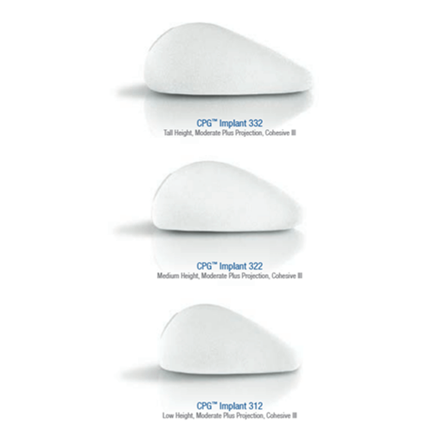 CPG™ Gel-Brustimplantate : Heintel